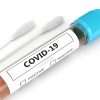 COVID-19 Nasal Swab Test